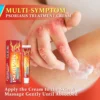 Furzero™ PsoriaKing Psoriasis Antibacterial Treatment Cream