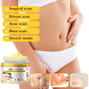 Lotmay™ Bee Venom Scar Removal and Intimate Area Acne Removal Cream