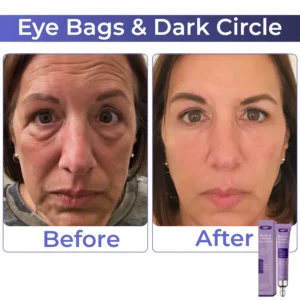 AQA™ Retinol Cream for Dark Circles & Wrinkles