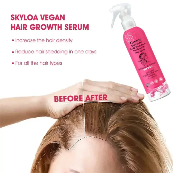 Cvreoz BeeVenom Scalp Treatment HairGrowth Hair Spray