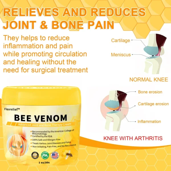 Flexrelief™ Bee Venom Advanced Joint and Bone Healing Cream