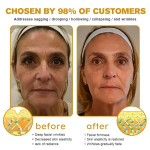 LOVILDS™ Botox Wrinkle Removal Cream