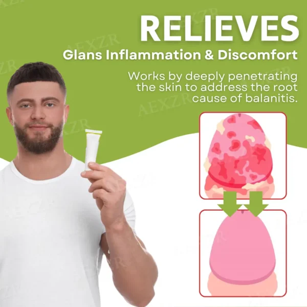 LOVILDS™ GlansCare Anti-Inflammation Cream