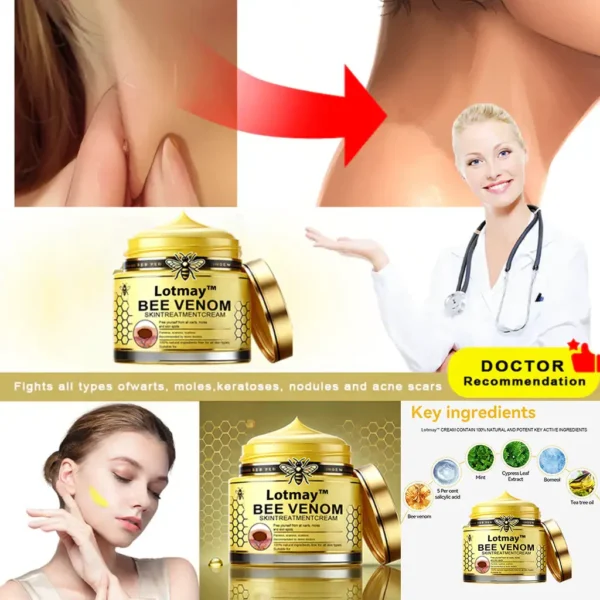 Lotmay™ Bee Venom Skin Treatment Cream