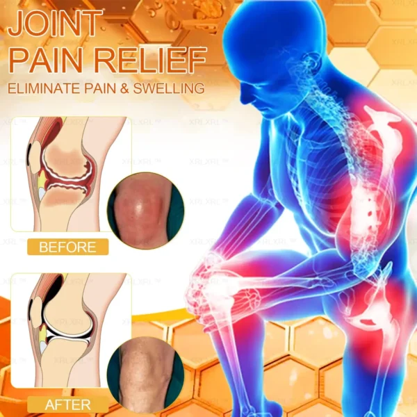 XRLXRL™ Bee Venom Pain Relief Bone Healing Cream