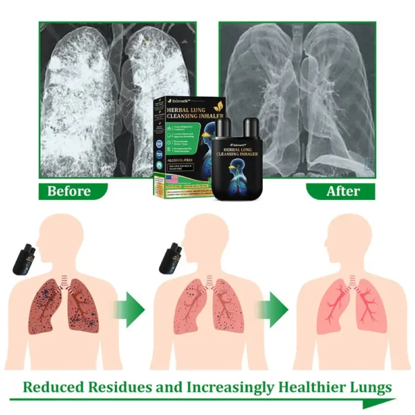 Ezbreath™ Herbal Lung Cleansing Inhaler