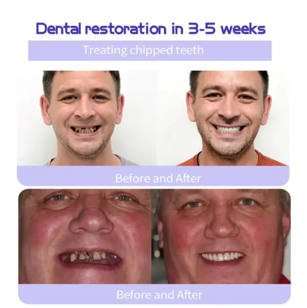 Fivfivgo™ Teeth Restoration Mineral Powder