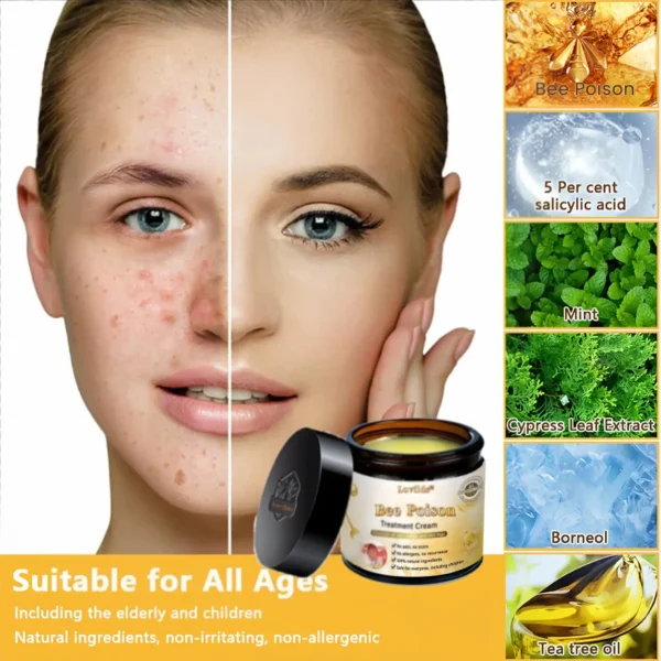 Lovilds™ Bee Poison Skin Treatment Cream