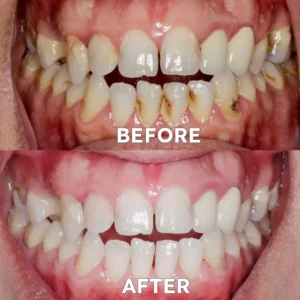 Ourlyard™ Teeth Restoration Mineral Powder